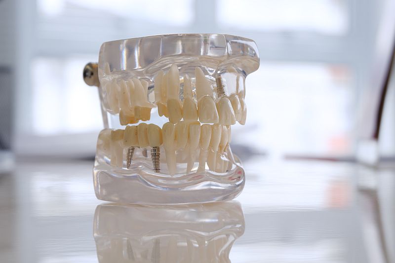 Closeup shot of a transparent dental prosthesis in a dental clinic